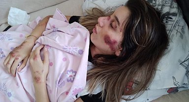Skuter sürücüsü hemşire taburcu edildi