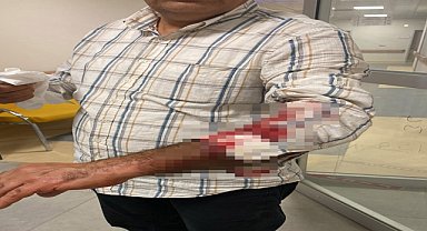 Sahipsiz köpeklerin saldırdığı kişi yaralandı
