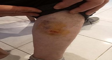 Sahipsiz köpeklerin saldırısına uğrayan kişi yaralandı