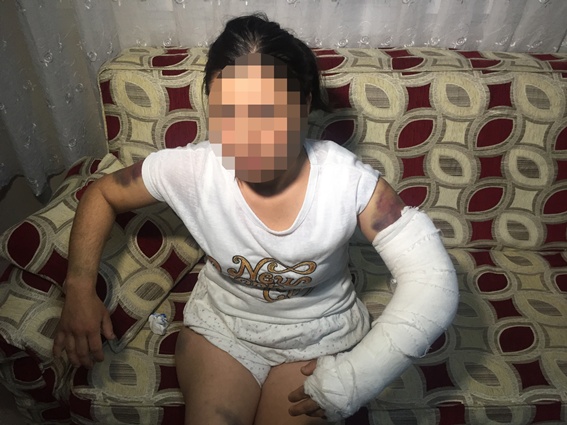 Kocası inşaat demiriyle dövdü
