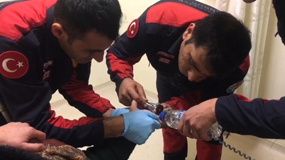 İtfaiyeden acil serviste yüzük operasyonu