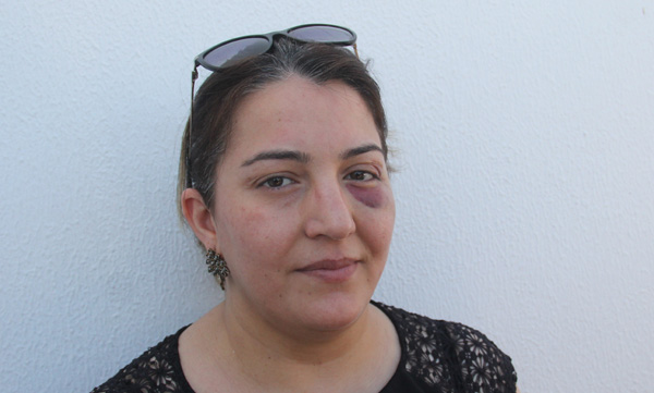 Yaralıya müdahale eden hemşire bu hale getirildi