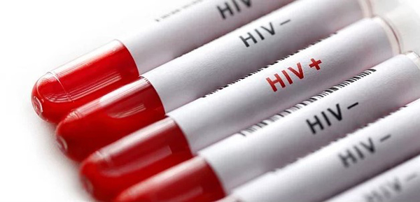 AIDS, 32 milyon can aldı
