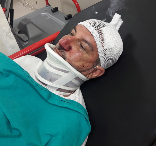 Dünürü öldüresiye dövdüler