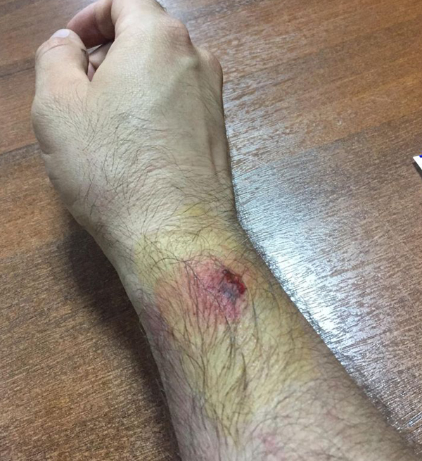 Polise mukavemet gösteren 4 kişi serbest bırakıldı
