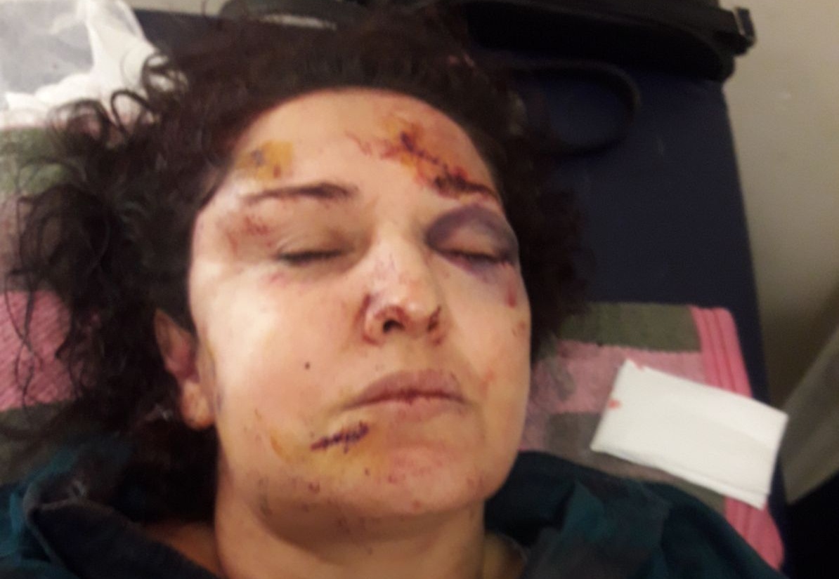 Kozan’da kadına şiddet