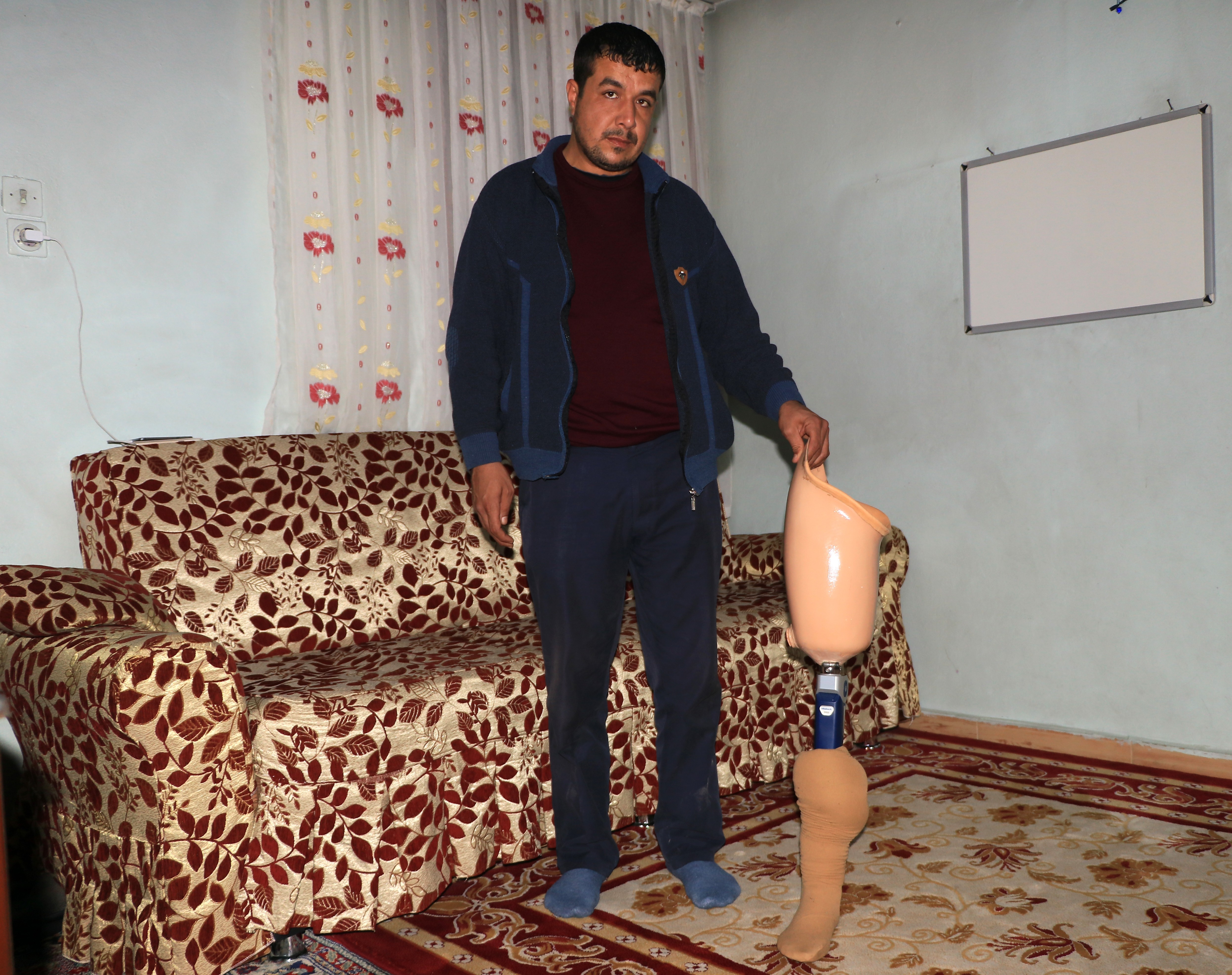 Ölen eşinin protez bacağını bağışlayacak ihtiyaç sahibi arıyor